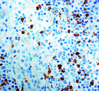 Anti-CD15 Mouse Monoclonal Antibody [clone: MMA]