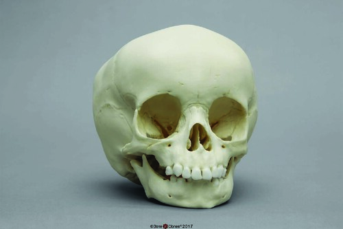 BoneClones® Juvenile Human Skulls