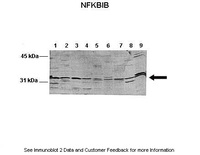 Anti-NFKBIB Rabbit Polyclonal Antibody