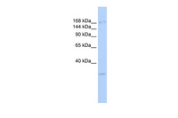 Anti-KDM6A Rabbit Polyclonal Antibody