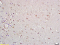 Anti-TR1 Rabbit Polyclonal Antibody