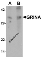 Anti-GRINA Rabbit Polyclonal Antibody