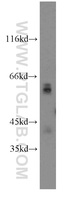 Anti-GPC4 Rabbit Polyclonal Antibody