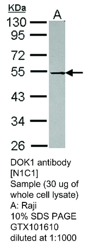 Rabbit Polyclonal antibody to DOK1 (docking protein 1, 62kDa (downstream of tyrosine kinase 1))
