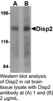 Anti-DISP2 Rabbit Polyclonal Antibody