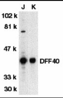 Anti-DFFB Rabbit Polyclonal Antibody
