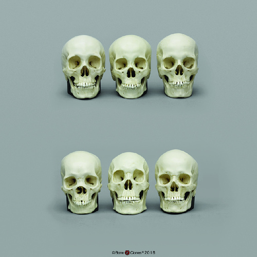 BoneClones® 1:2 Scale Regional Human Skull Sets