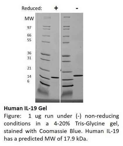 Human Recombinant IL-19 (from <i>E. coli</i>)