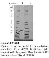 Human Recombinant IL-19 (from E. coli)