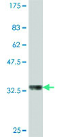 Anti-AGPAT3 Mouse Polyclonal Antibody