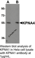 Anti-KPNA4 Rabbit Polyclonal Antibody