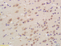 Anti-CACNA1D Rabbit Polyclonal Antibody