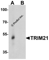 Anti-TRIM21 Rabbit Polyclonal Antibody