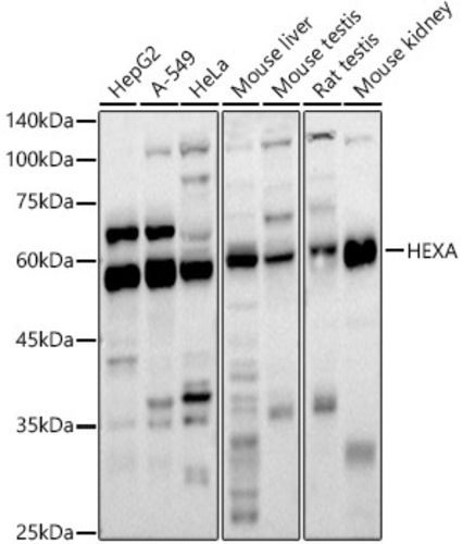 Anti-HEXA Rabbit Polyclonal Antibody