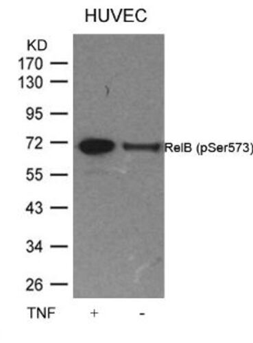 RelB (phospho Ser573) Antibody