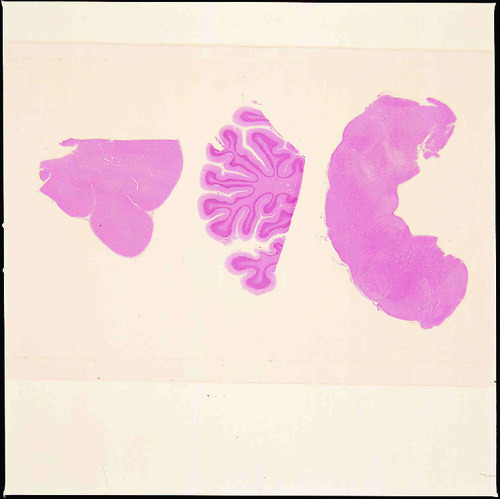 BRAIN COMPOSITE (SECT) H/E   M CEREBRUM