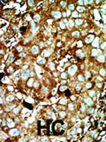 Anti-PFKFB3 Rabbit Polyclonal Antibody