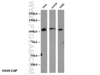 Anti-NFKB2 Rabbit Polyclonal Antibody