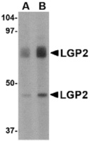 Anti-DHX58 Rabbit Polyclonal Antibody
