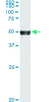 Anti-ANGPTL5 Antibody Pair