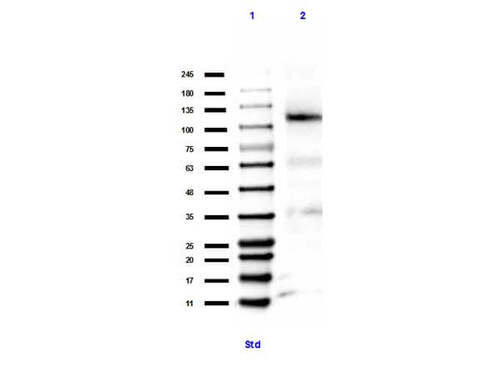 Retinoblastoma K860 Me1 Polyclonal Antibody 25UL