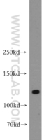 Anti-DLGAP3 Rabbit Polyclonal Antibody