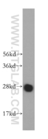 Anti-MED20 Rabbit Polyclonal Antibody