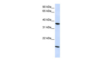 Anti-CLDN16 Rabbit Polyclonal Antibody