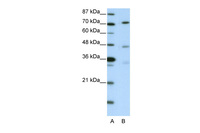 Anti-ATG4B Rabbit Polyclonal Antibody