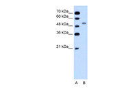 Anti-SLC12A1 Rabbit Polyclonal Antibody