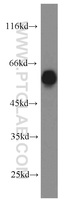 Anti-PRPF19 Rabbit Polyclonal Antibody