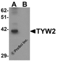 Anti-TRMT12 Rabbit Polyclonal Antibody