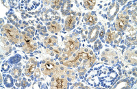Anti-TAF6 Rabbit Polyclonal Antibody
