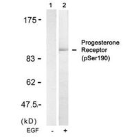 Anti-PGR Rabbit Polyclonal Antibody