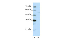 Anti-HNRNPK Rabbit Polyclonal Antibody