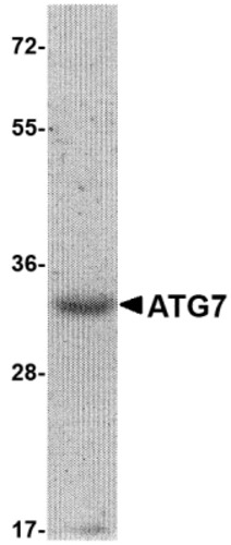 ATG7 Recombinant Protein, Species: Mouse, Host: E.coli
