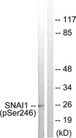 Anti-SNAI1 Rabbit Polyclonal Antibody