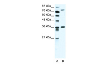 Anti-MID1 Rabbit Polyclonal Antibody