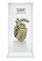 Ward's® Heart Anatomy Museum Mount