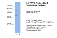 Anti-PTPN2 Rabbit Polyclonal Antibody