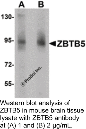Antibody ZBTB5 0.1MG