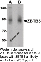 Anti-ZBTB5 Rabbit Polyclonal Antibody