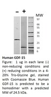 Human Recombinant GDF-15 (from E. coli)