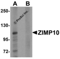 Anti-ZMIZ1 Rabbit Polyclonal Antibody