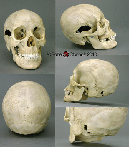 Human Female Skull Model 19.9L x 13.9W x 20.2H (cm)