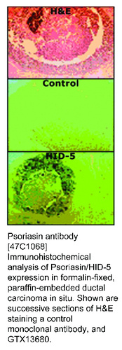 Mouse Monoclonal antibody to Psoriasin (S100 calcium binding protein A7)