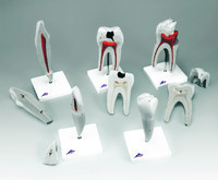 3B Scientific® Classic Tooth Models