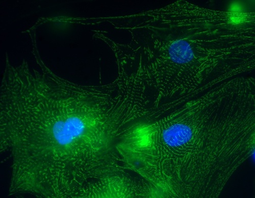 R-CM Rat Cardiac Myocytes, Cryopreserved, in RCGM* BulletKit, =4 million cells/vial