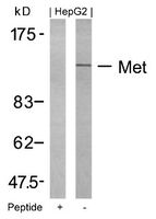Anti-MET Rabbit Polyclonal Antibody