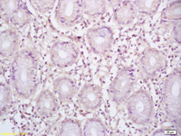 Anti-BCL6 Rabbit Polyclonal Antibody